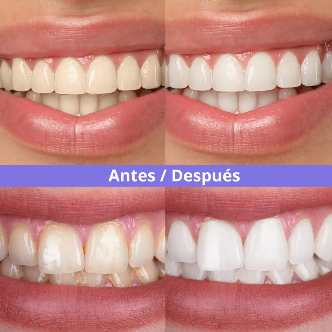 Tiras violetas Blanqueadoras, Sonrisa blanca en minutos.