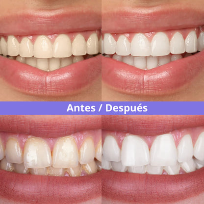 Tiras violetas Blanqueadoras, Sonrisa blanca en minutos.