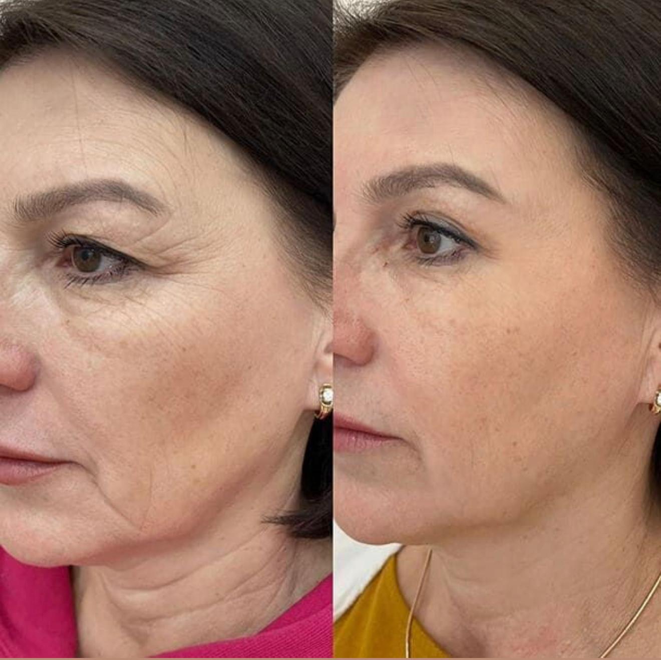 Ana María, 52 años