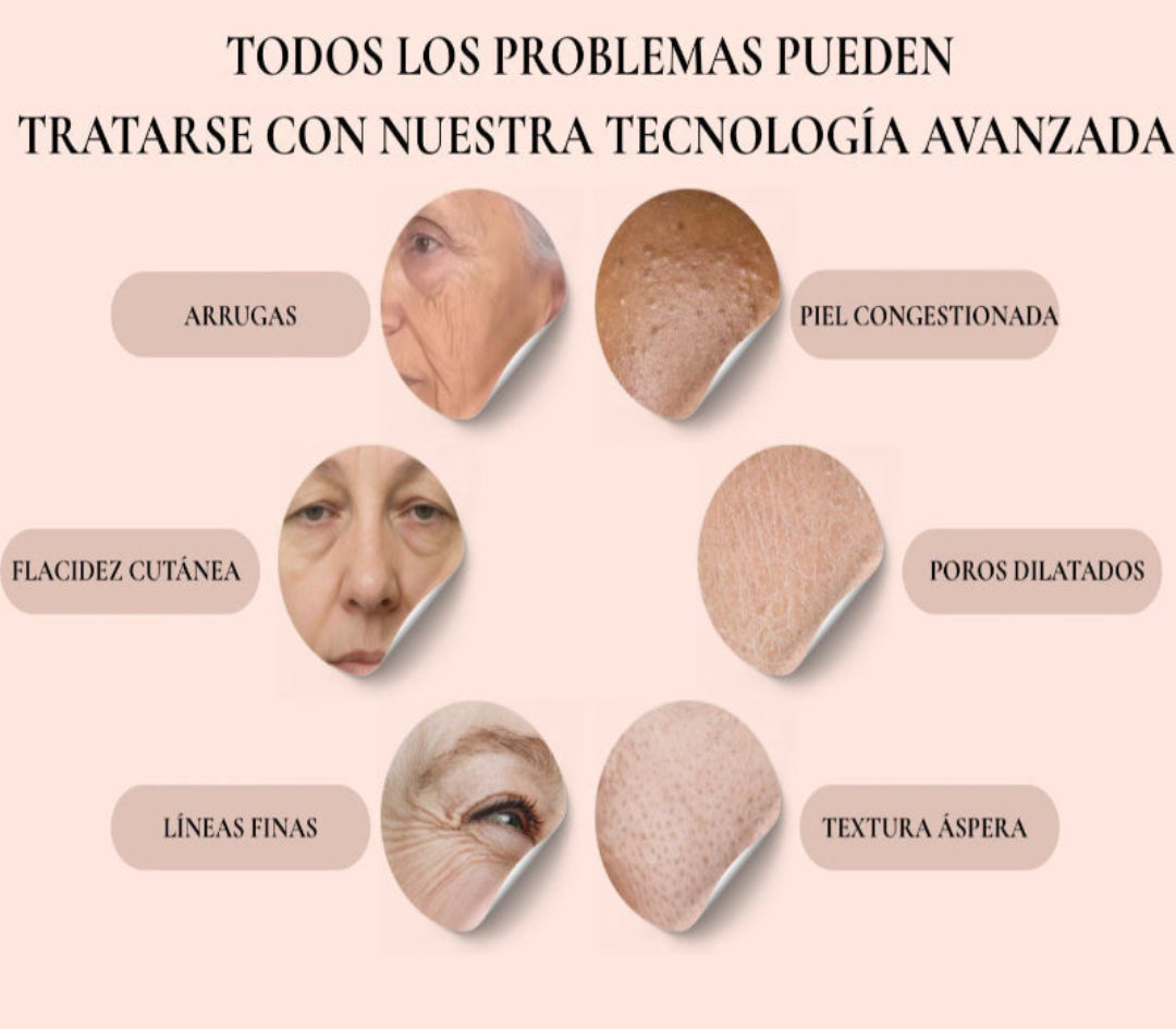 MASAJEADOR FACIAL reafirma y da efecto lifting, SUNMAY