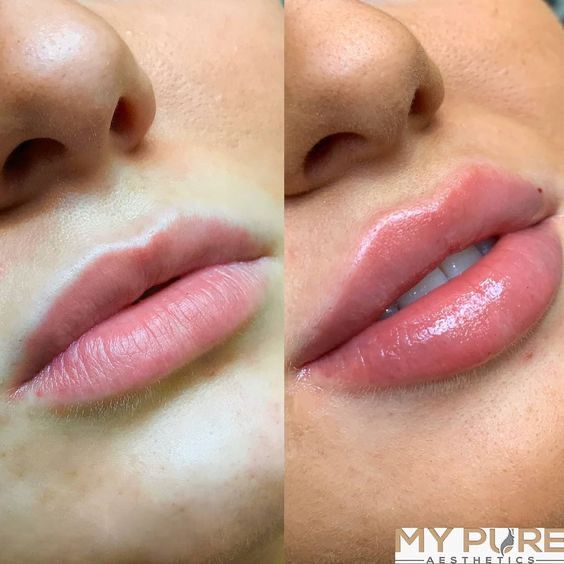 Marina Gómez, 27 años