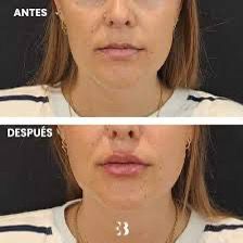 Daniela Rojas, 29 años